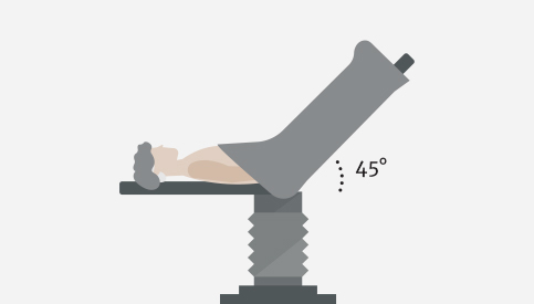 Passive leg raise (PLR)